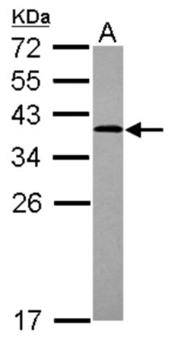 ARH Antibody, Novus Biologicals 0.1mL; Unlabeled:Antibodies, Polyclonal