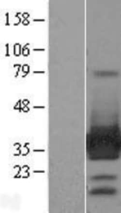 Novus Biologicals™ ARH Overexpression Lysate