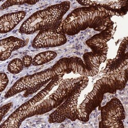 ARHGAP12 Antibody, Novus Biologicals:Antibodies:Primary Antibodies