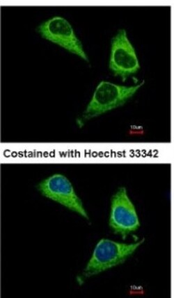 ARHGAP15 Antibody, Novus Biologicals 0.1mL; Unlabeled:Antibodies, Polyclonal