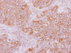 ARHGAP15 Antibody, Novus Biologicals 0.1mL; Unlabeled:Antibodies, Polyclonal