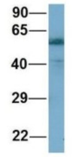 ARHGAP15 Antibody, Novus Biologicals:Antibodies:Primary Antibodies