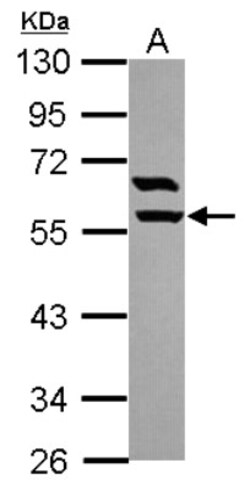 ARHGAP15 Antibody, Novus Biologicals 0.1mL; Unlabeled:Antibodies, Polyclonal