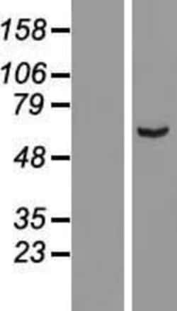 Novus Biologicals™ ARHGAP15 Overexpression Lysate