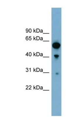 ARHGAP15 Antibody, Novus Biologicals:Antibodies:Primary Antibodies