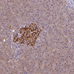 ARHGAP19 Antibody, Novus Biologicals 0.1mL; Unlabeled:Antibodies, Polyclonal