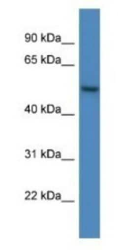 ARHGAP19 Antibody, Novus Biologicals:Antibodies:Primary Antibodies