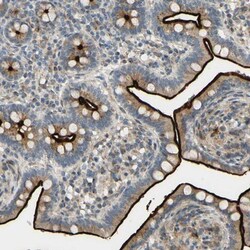 ARHGAP1 Antibody, Novus Biologicals 0.1mL; Unlabeled:Antibodies, Polyclonal