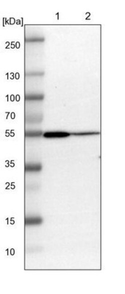 ARHGAP1 Antibody, Novus Biologicals 0.1mL; Unlabeled:Antibodies, Polyclonal