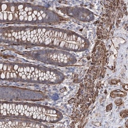 ARHGAP20 Antibody, Novus Biologicals 25 &mu;L, Unlabeled:Antibodies, Polyclonal