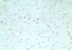 ARHGAP20 Antibody, Novus Biologicals:Antibodies:Primary Antibodies