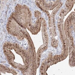 ARHGAP21 Antibody, Novus Biologicals 0.1mL; Unlabeled:Antibodies, Polyclonal