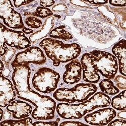 ARHGAP22 Antibody, Novus Biologicals:Antibodies:Primary Antibodies