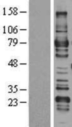 Novus Biologicals™ ARHGAP25 Overexpression Lysate