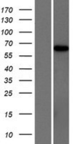 Novus Biologicals&trade;&nbsp;ARHGAP28 Overexpression Lysate