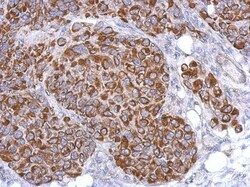 ARHGAP9 Antibody, Novus Biologicals 0.1mL; Unlabeled:Antibodies, Polyclonal
