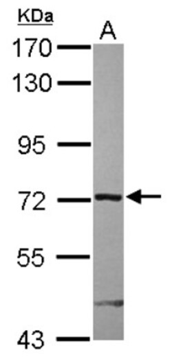 ARHGAP9 Antibody, Novus Biologicals 0.1mL; Unlabeled:Antibodies, Polyclonal