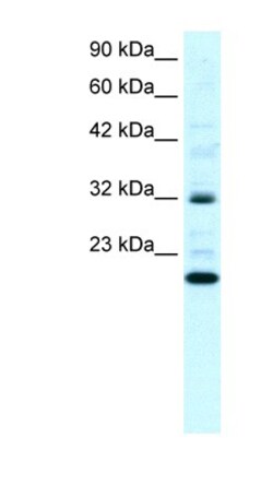 ARHGDIG Antibody, Novus Biologicals 100&mu;L; Unlabeled:Antibodies, Polyclonal