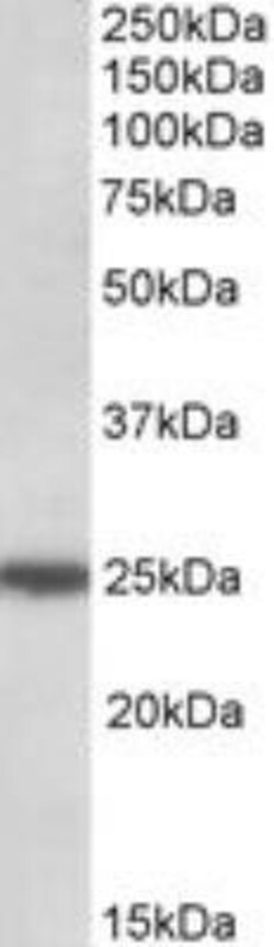 ARHGDIG Antibody, Novus Biologicals 0.1mg; Unlabeled:Antibodies, Polyclonal
