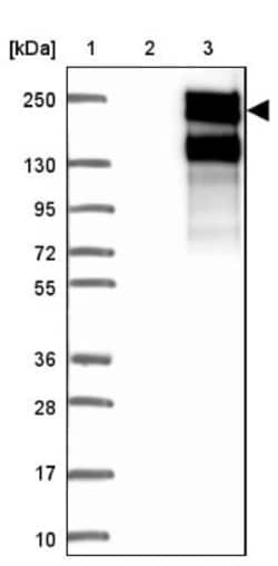 ARHGEF11 Antibody, Novus Biologicals 25 &mu;L | Buy Online | Novus Biologicals | Fisher Scientific
