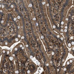 ARHGEF11 Antibody, Novus Biologicals 25 &mu;L | Buy Online | Novus Biologicals | Fisher Scientific
