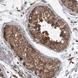 ARHGEF11 Antibody, Novus Biologicals:Antibodies:Primary Antibodies