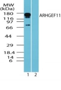 ARHGEF11 Antibody, Novus Biologicals 0.1mg; Unlabeled:Antibodies, Polyclonal