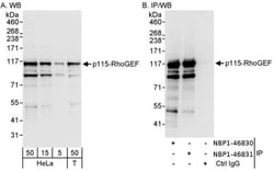 ARHGEF1 Antibody, Novus Biologicals 0.1mL; Unlabeled:Antibodies, Polyclonal