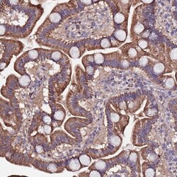 ARHGEF35 Antibody, Novus Biologicals:Antibodies:Primary Antibodies