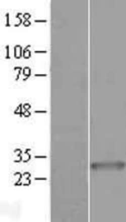 Novus Biologicals&trade;&nbsp;ARHGEF38 Overexpression Lysate