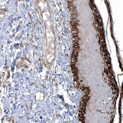 ARHGEF38 Antibody, Novus Biologicals:Antibodies:Primary Antibodies