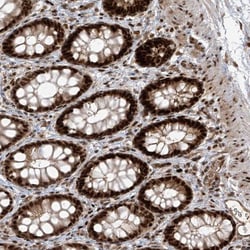 ARHGEF3 Antibody, Novus Biologicals:Antibodies:Primary Antibodies