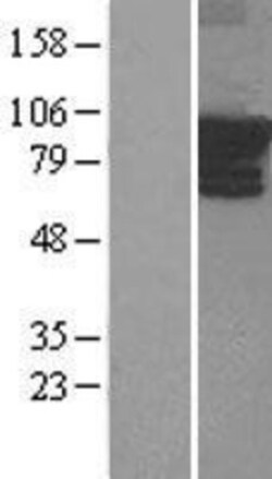 Novus Biologicals™ ARHGEF4 Overexpression Lysate