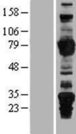 Novus Biologicals&trade;&nbsp;ARHGEF7 Overexpression Lysate