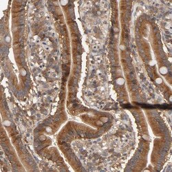 ARHGEF7 Antibody, Novus Biologicals 25 &mu;L; Unlabeled:Antibodies, Polyclonal