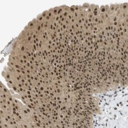 ARID1B Antibody, Novus Biologicals 25 &mu;L | Buy Online | Novus Biologicals | Fisher Scientific