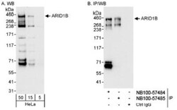 ARID1B Antibody, Novus Biologicals 0.1mL; Unlabeled:Antibodies, Polyclonal
