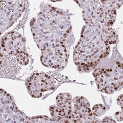 ARID3B Antibody, Novus Biologicals 0.1mL; Unlabeled:Antibodies, Polyclonal