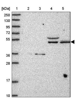 ARID3B Antibody, Novus Biologicals 0.1mL; Unlabeled:Antibodies, Polyclonal