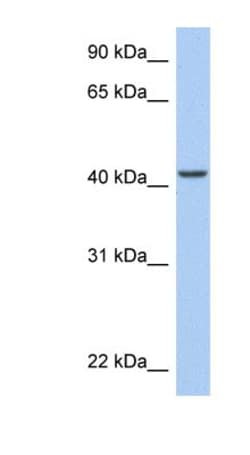ARID3C Antibody, Novus Biologicals 100 &mu;L | Buy Online | Novus Biologicals | Fisher Scientific