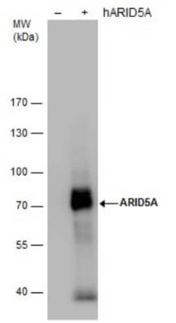 ARID5A Antibody (18112), Novus Biologicals 0.1mL; Unlabeled:Antibodies,