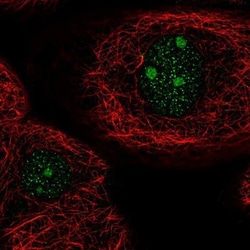 ARID5A Antibody, Novus Biologicals 25 &mu;L; Unlabeled:Antibodies, Polyclonal