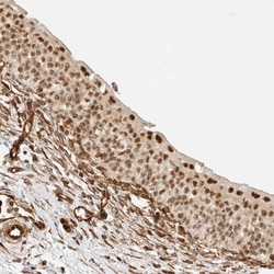ARID5A Antibody, Novus Biologicals 25 &mu;L; Unlabeled:Antibodies, Polyclonal