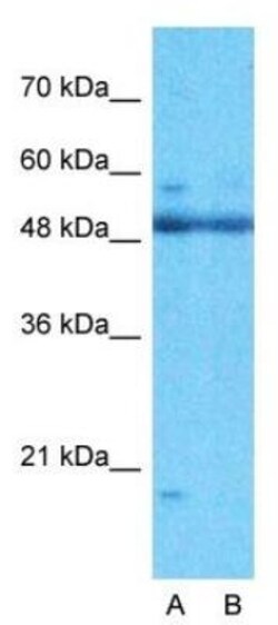 ARID5A Antibody, Novus Biologicals 0.05mg; Unlabeled:Antibodies, Polyclonal