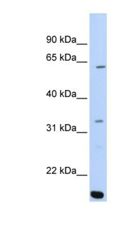 ARID5A Antibody, Novus Biologicals 0.05mg; Unlabeled:Antibodies, Polyclonal
