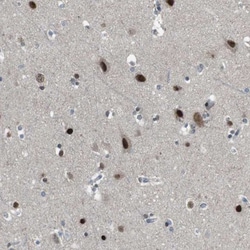 ARID5B Antibody, Novus Biologicals 0.1mL; Unlabeled:Antibodies, Polyclonal