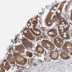 ARIH1 Antibody, Novus Biologicals:Antibodies:Primary Antibodies