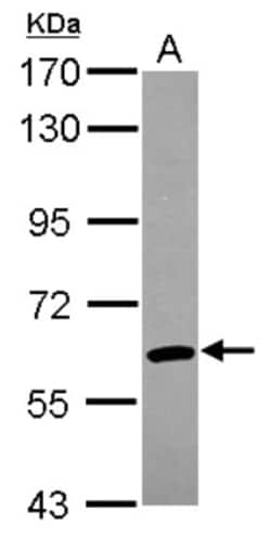 ARIH2 Antibody, Novus Biologicals 0.1mL; Unlabeled:Antibodies, Polyclonal