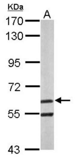 ARIH2 Antibody, Novus Biologicals 0.1mL; Unlabeled:Antibodies, Polyclonal