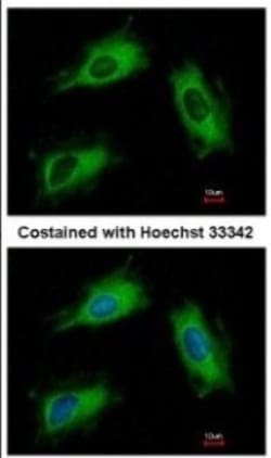 ARL1 Antibody, Novus Biologicals 0.1mL; Unlabeled:Antibodies, Polyclonal